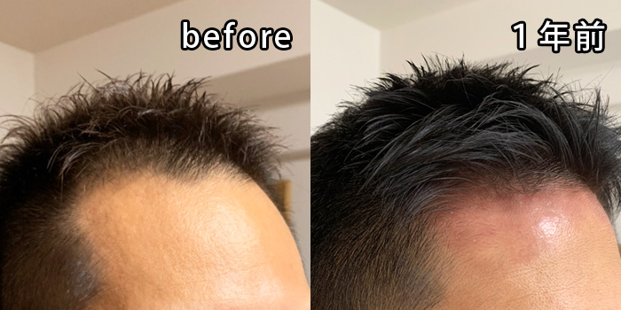 1年前のヘアセットをした時の比較